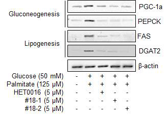 #18-1 및 #18-2의 처리에 의한 Gluconeogenesis 및 lipogenesis 단백질 발현 감소