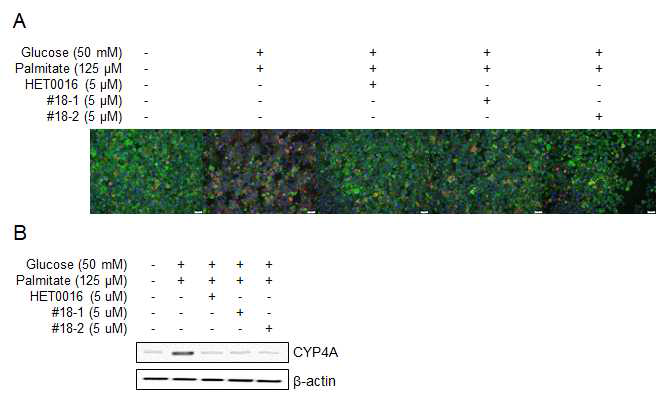 #18-1 및 #18-2의 처리에 따른 CYP4A의 발현 감소 (A) Immunocytochemistry (B) Western blot