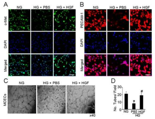 HGF protein transfer enhances tube formation in primary cultured mouse cavernous endothelial cells (MCECs) exposed to high-glucose condition