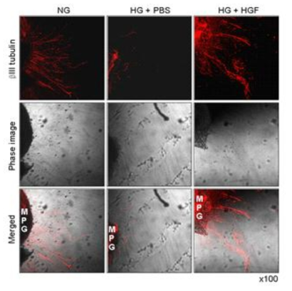 HGF protein transfer induces neurite outgrowth in cultured mouse pelvic ganglion (MPG) tissue exposed to high-glucose condition