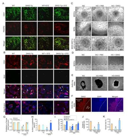 DKK2 overexpression is resistant to diabetes-induced angiopathy