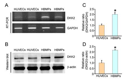 DKK2 is mainly expressed in pericytes