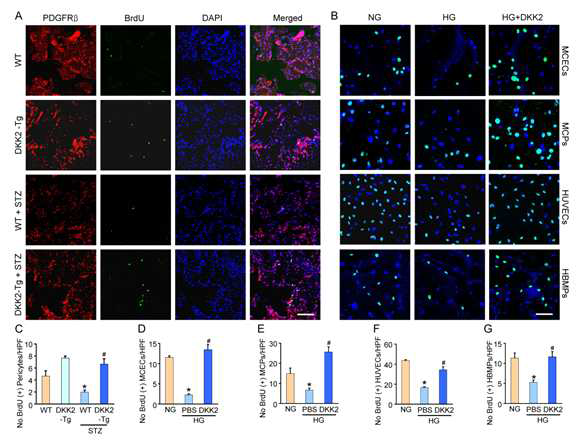 DKK2 overexpression enhances proliferation of endothelial cells and pericytes