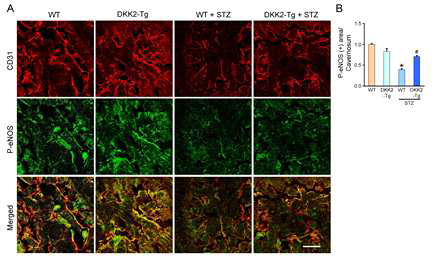 Preserved eNOS phosphorylation in DKK2-Tg mice under diabetic conditions