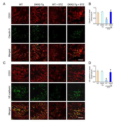 Preserved endothelial cell-cell junction proteins in DKK2-Tg mice under diabetic conditions