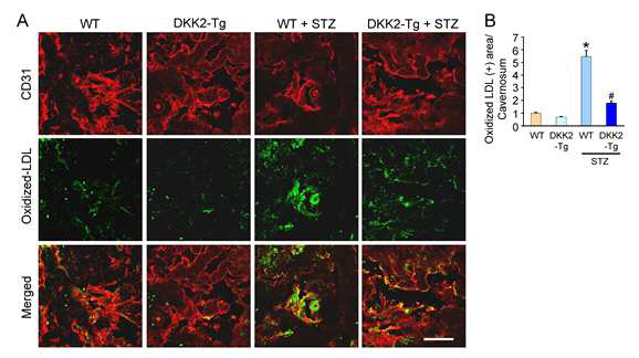 DKK2-Tg mice decrease the extravasation of oxidized-LDL under diabetic conditions