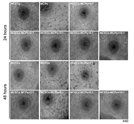 Establishment of a direct mixed MCEC-MCP co-culture system