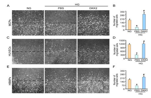 DKK2 overexpression promotes migration of endothelial cells and pericytes