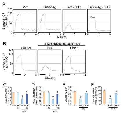 DKK2 overexpression is resistant to diabetes-induced erectile dysfunction