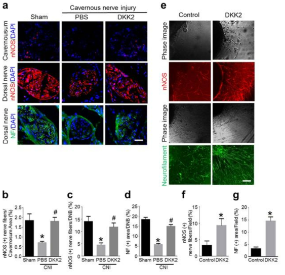 DKK2 induces neural regeneration. (a) nNOS (red) and neurofilament (NF, green) staining of penis tissue from sham operation group or CNI mice 1 week after receiving intracavernous injections of PBS (20 μl) or DKK2 protein (days -3 and 0; 6 μg/20 μl). Nuclei were labeled with DAPI (blue). Scale bar = 100 μm. (b-d) Quantitative analysis of cavernous nNOS- and neurofilament-immunopositive area in cavernous tissue or dorsal nerve bundle (DNB) was performed by an image analyzer. Each bar depicts the mean (± SE) values from n = 6 animals per group. *P < 0.05 vs. sham operation group, #P < 0.05 vs. PBS-treated CNI group. (e) Neurofilament (green) and nNOS (red) staining in mouse major pelvic ganglion (MPG) tissue, which were treated with PBS or DKK2 protein (300 ng/ml). Scale bar = 100 μm. (f, g) Quantitative analysis of neurofilament- or nNOS-immunopositive neurite length was performed by an image analyzer. Each bar depicts the mean (± SE) values from n = 4 independent experiments. *P < 0.001 vs. control group. CNI = cavernous nerve injury; DKK2 = dickkopf2; nNOS, neuronal nitric oxide synthase