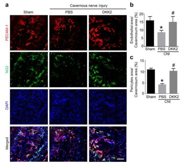 DKK2 restores cavernous endothelial and pericyte content. (a) PECAM-1 (red) and NG2 (green) staining of cavernous tissue from sham operation group or CNI mice 1 week after receiving intracavernous injections of PBS (20 μl) or DKK2 protein (days -3 and 0; 6 μg/20 μl). Nuclei were labeled with DAPI (blue). Scale bar = 100 μm. (b, c) Quantitative analysis of cavernous endothelial cell and pericyte content was performed by an image analyzer. Each bar depicts the mean (± SE) values from n = 6 animals per group. *P < 0.05 vs. sham operation group, #P < 0.05 vs. PBS-treated CNI group. CNI = cavernous nerve injury; DKK2 = dickkopf2