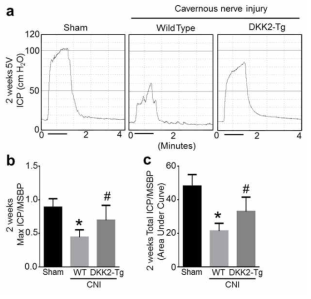 DKK2-Tg mice are resistant to CNI-induced erectile dysfunction. (a) Representative ICP responses for the wild-type (WT) mice receiving sham operation, WT mice receiving CNI, or DKK2-Tg mice receiving CNI. The stimulus interval is indicated by a solid bar. The ICP was measured 2 weeks after CNI. (b, c) Ratios of mean maximal ICP and total ICP (area under the curve) to mean systolic blood pressure (MSBP) were calculated for each group. Each bar depicts the mean (± SE) values from n = 6 animals per group. *P < 0.001 vs. WT + sham operation group, #P < 0.05 vs. WT + CNI group. CNI = cavernous nerve injury; DKK2-Tg = dickkopf2-transgenic mice