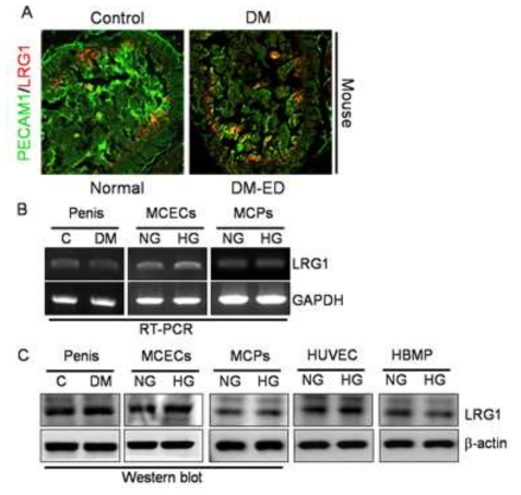 LRG1 expression in diabetic condition. (정상 및 당뇨조건의 음경조직. 음경 혈관내피세포, 음경 혈관 주위세포, 및 인간 혈관내피세포에서 LRG1의 발현차이는 없음. 인간 혈관주위세포에서 당뇨 조건하에서 LRG1의 발현이 감소함)