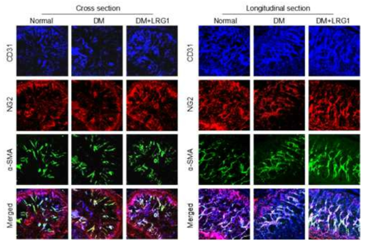 LRG1 protein regenerates endothelial cells and pericytes in diabetic mice. (3차원 영상 분석에서 LRG1 단백질이 당뇨 조건하에서 혈관주위세포 [NG2], 혈관내피세포 [CD31], 평활근세포 [α-actin]의 양을 회복함)