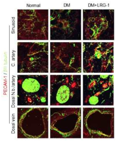LRG1 protein regenerates nerve contents in diabetic mice. (3차원 영상 분석에서 LRG1 단백질이 당뇨 조건하에서 신경세포 [bIII tubulin]의 양을 회복함)