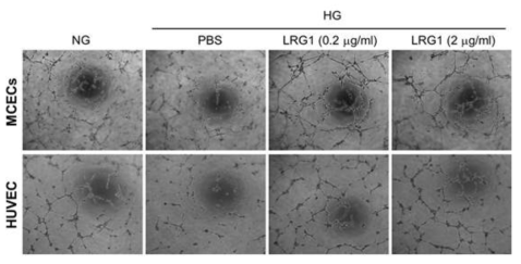 LRG1 increases tube formation in endothelial cells. MCECs, mouse cavernous endothelial cells; HUVEC, human umbilical vein endothelial cells. (음경 혈관내피세포 및 인간제대정맥 내피세포에서 LRG1 단백질이 고 글루코스 조건에 의해 저해된 튜브형성을 정상 글루코스 조건 수준으로 회복시킴)