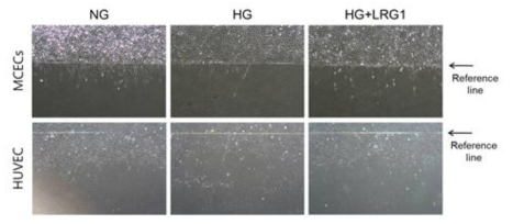 LRG1 enhances endothelial cell migration. (음경 혈관내피세포 및 인간제대정맥 내피세포에서 LRG1 단백질이 고 글루코스 조건에 의해 저해된 세포이동을 정상 글루코스 조건 수준으로 회복시킴)