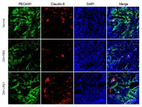 LRG1 transfer increases cavernous endothelial tight junction protein in diabetic mice. (당뇨조건의 음경조직에서 LRG1 단백질이 당뇨 의해 감소된 혈관내피세포 tight junction protein의 발현을 증가시킴)