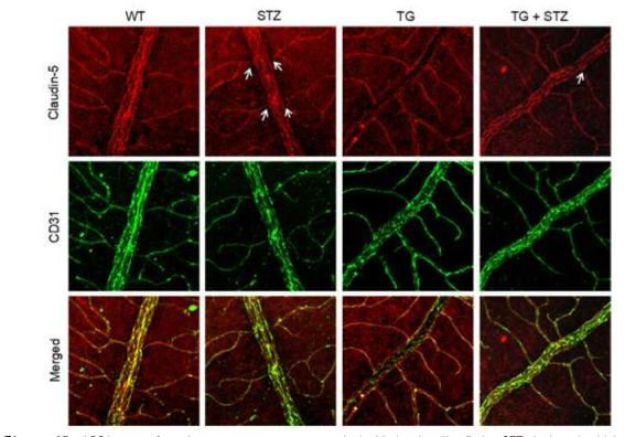 LRG1 transfer decreases cavernous endothelial claudin-5 in STZ induced wild type or LRG1 Tg mice retina. (wild type 와 lrg1 tg 마우스 당뇨조건의 망막조직에서 LRG1 단백질이 당뇨 의해 감소된 혈관내피세포 tight junction protein의 발현을 증가시킴)