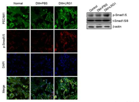 LRG1 transfer induces phosphorylation of Smad1/5 in diabetic mice. (LRG1 단백질의 음경 내 국소 투여가 당뇨성 발기부전모델의 음경에서 혈관신생과 관련된 Smad1/5 인산화를 촉진함)