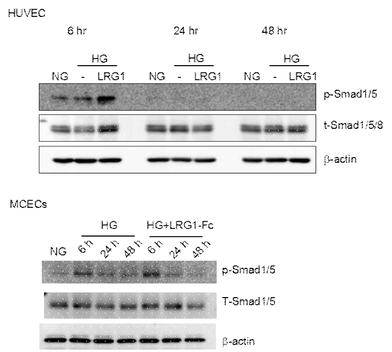 LRG1 transfer induces phosphorylation of Smad1/5 in huvec and mcecs. (LRG1 단백질이 음경혈관내피세포 및 인간제대정맥에서 혈관신생과 관련된 Smad1/5 인산화를 촉진함)