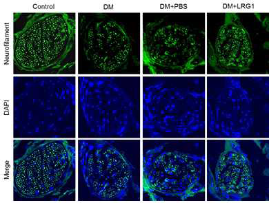 LRG1 transfer restores neurofilament expression in diabetic mice. (LRG1 단백질의 음경 내 국소 투여가 당뇨성 발기부전모델의 음경 배부신경에서 neurofilament 발현을 촉진함)