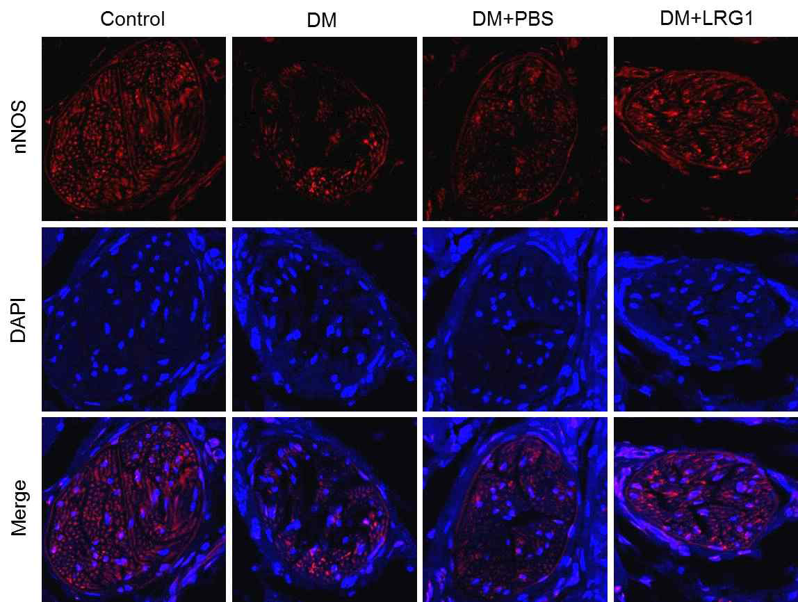 LRG1 transfer restores nNOS expression in the dorsal nerve bundle of diabetic mice. (LRG1 단백질의 음경 내 국소 투여가 당뇨성 발기부전모델의 음경 배부신경에서 nNOS 발현을 촉진함)