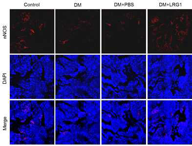 LRG1 transfer restores nNOS expression in the corpus cavernosum of diabetic mice. (LRG1 단백질의 음경 내 국소 투여가 당뇨성 발기부전모델의 음경 발기조직에서 nNOS 발현을 촉진함)