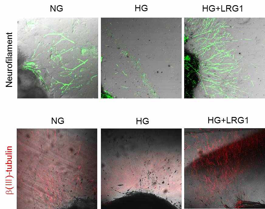 LRG1 transfer induces neurite sprouting in cultured mouse major pelvic ganglion (MPG). (주골반신경절을 이용한 실험에서 LRG1 단백질이 고 글루코오즈 조건에 의해 저해된 neurite sprouting을 정상 글루코오즈 조건 수준으로 회복시킴)