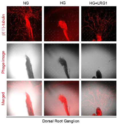 LRG1 transfer induces neurite sprouting in cultured mouse Dorsal Root Ganglion (DRG). (후근신경절을 이용한 실험에서 LRG1 단백질이 고 글루코오즈 조건에 의해 저해된 neurite sprouting을 정상 글루코오즈 조건 수준으로 회복시킴)