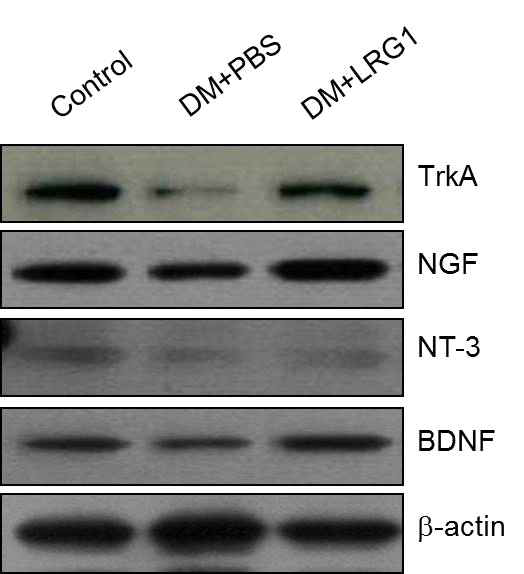 LRG1 transfer restores neurotrophic factors and their receptors in diabetic mice. (LRG1 단백질의 음경 내 국소 투여가 당뇨성 발기부전모델의 음경 발기조직에서 NGF, NT-3, BDNF 등의 신경재생인자와 NGF 수용체인 TrkA의 발현을 촉진함)