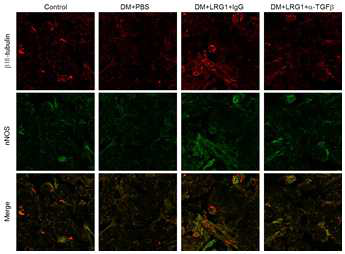 Inhibition of TGFb signaling blocks LRG1-mediated neural regeneration in diabetic mice. (당뇨성 발기부전모델에서 LRG1 단백질에 의해 회복된 음경 내 신경세포의 양이 TGFb blocking antibody [aTGFb]에 의해 다시 억제됨)