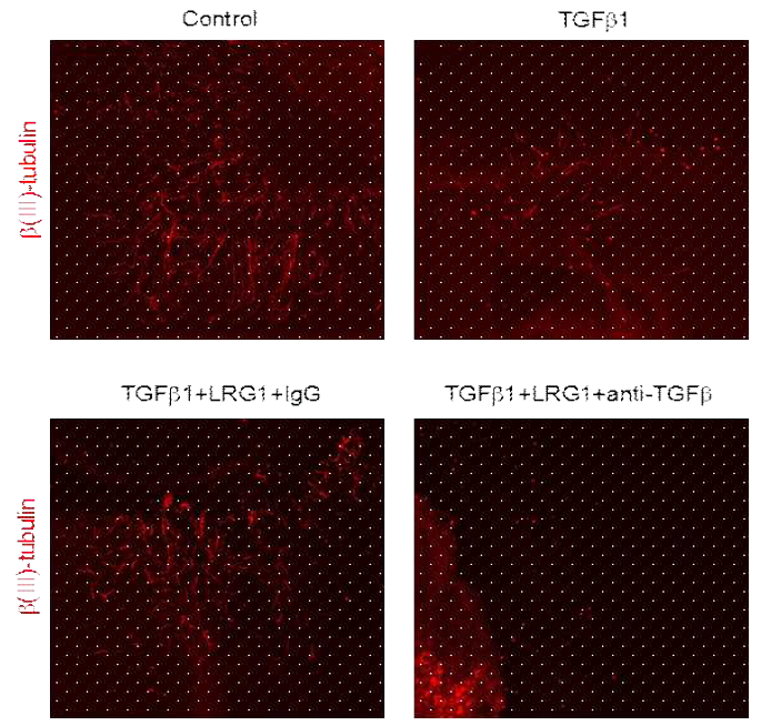 Inhibition of TGFb signaling blocks LRG1-mediated neurite sprouting in cultured mouse major pelvic ganglion (MPG) (주골반신경절을 이용한 실험에서 TGFb 처리한 조건에서 LRG1 단백질에 의해 촉진된 neurite sprouting이 TGFb 신호전달 억제제 [aTGFb]에 의해 다시 억제됨)