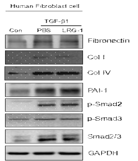 LRG1 does not affect on the TGF-beta1-induced expression of extracellular matricx protein in human penile fibroblasts. (인간의 음경에서 일차 분리배양된 섬유모세포에서 LRG1 단백질이 TGFb1에 의해 유도된 extracellular matrix protein 발현 증가를 감소시키지 못함)