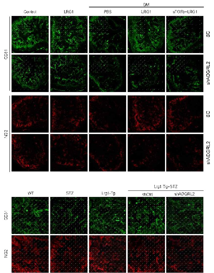 LRG1-mediated restoration of cavernous endothelial and pericyte contents via ADGRL2 pathway in wild type and LRG1 Tg diabetic mice. (당뇨마우스에서 LRG1에 의한 혈관내피세포, 혈관주위세포의 재생이 ADGRL2를 억제하였을 때는 나타나지 않음)