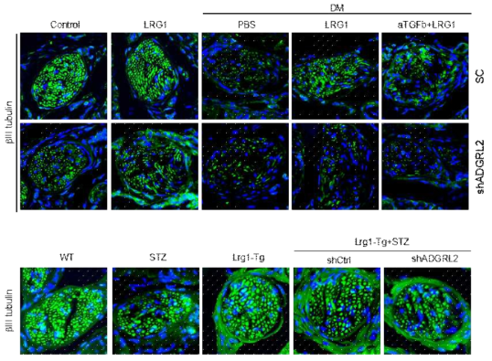 LRG1-mediated neural regeneration via ADGRL2 pathway in wild type and LRG1 Tg diabetic mice. (당뇨마우스에서 LRG1에 의한 신경세포의 ADGRL2를 억제하였을 때는 나타나지 않음)