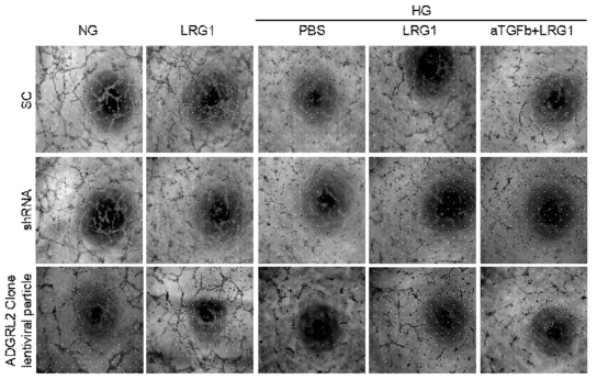 LRG1 induced angiogenesis via ADGRL2 pathway in MCECs. (음경 혈관내피세포에서 LRG1에 의한 튜브형성 촉진이 ADGRL2를 억제하였을 때는 나타나지 않음)