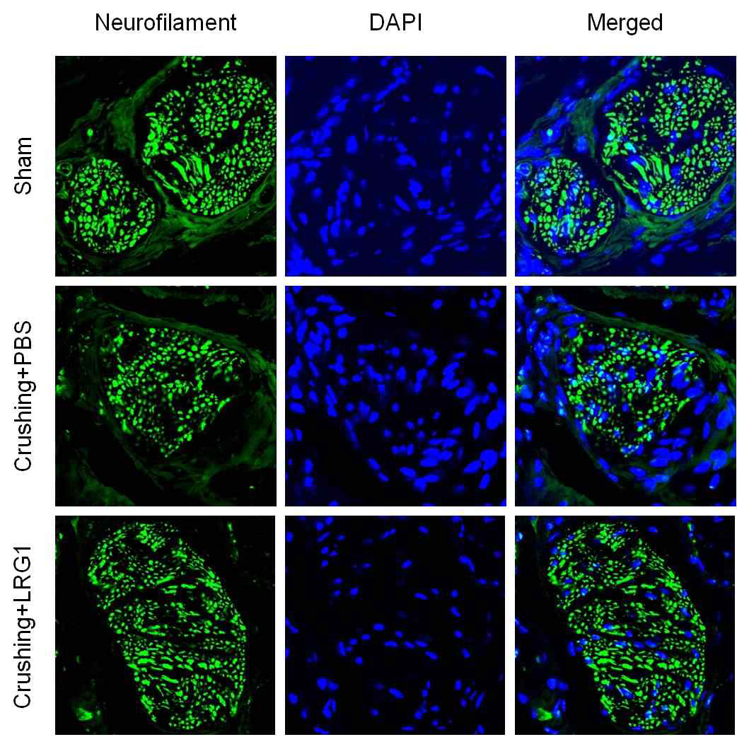 LRG1 increases neurofilament expression in dorsal nerve bundle of bilateral cavernous nerve crushing mice