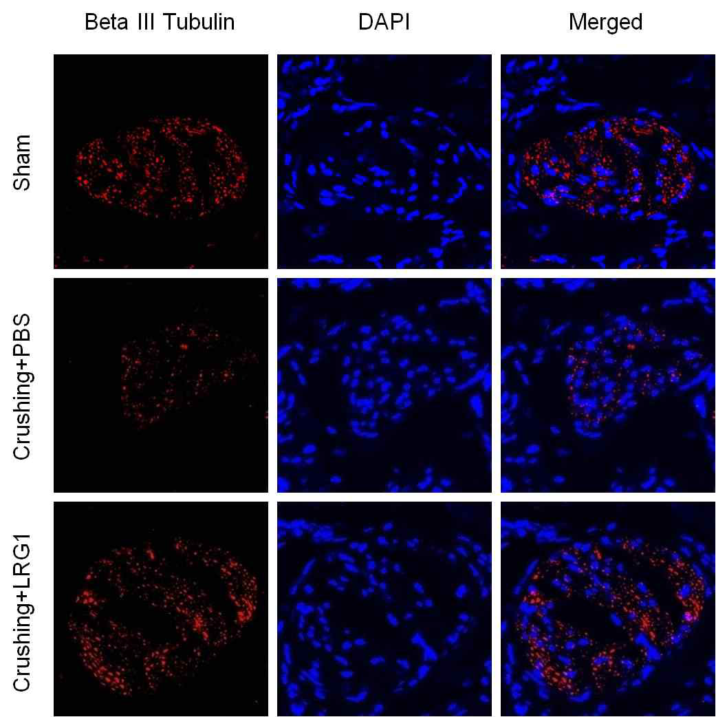 LRG1 increases Beta Ⅲ Tubulin in dorsal nerve bundle of bilateral cavernous nerve crushing mice