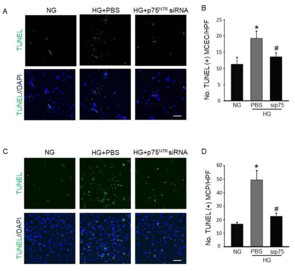 siRNA-mediated knockdown of p75NTR decreases endothelial cell and pericyte apoptosis under diabetic conditions. (A) TUNEL assay in primary cultured mouse cavernous endothelial cells (MCEC) exposed to normal-glucose (NG) or high-glucose (HG) condition, which were treated with siRNA for p75NTR (siP75). Nuclei were labeled with DAPI (blue). Scale bar = 100 μm. (B) Number of apoptotic cells per field (screen magnification ´40) (N = 7). *P < 0.05 vs. NG group; #P < 0.05 vs. HG + PBS group. (C) TUNEL assay in mouse cavernous pericytes (MCP). Scale bar = 100 μm. (D) Number of apoptotic cells per field (screen magnification ´40) (N = 4). *P < 0.05 vs. NG group; #P < 0.05 vs. HG + PBS group. Data in graphs are presented as mean ± SE