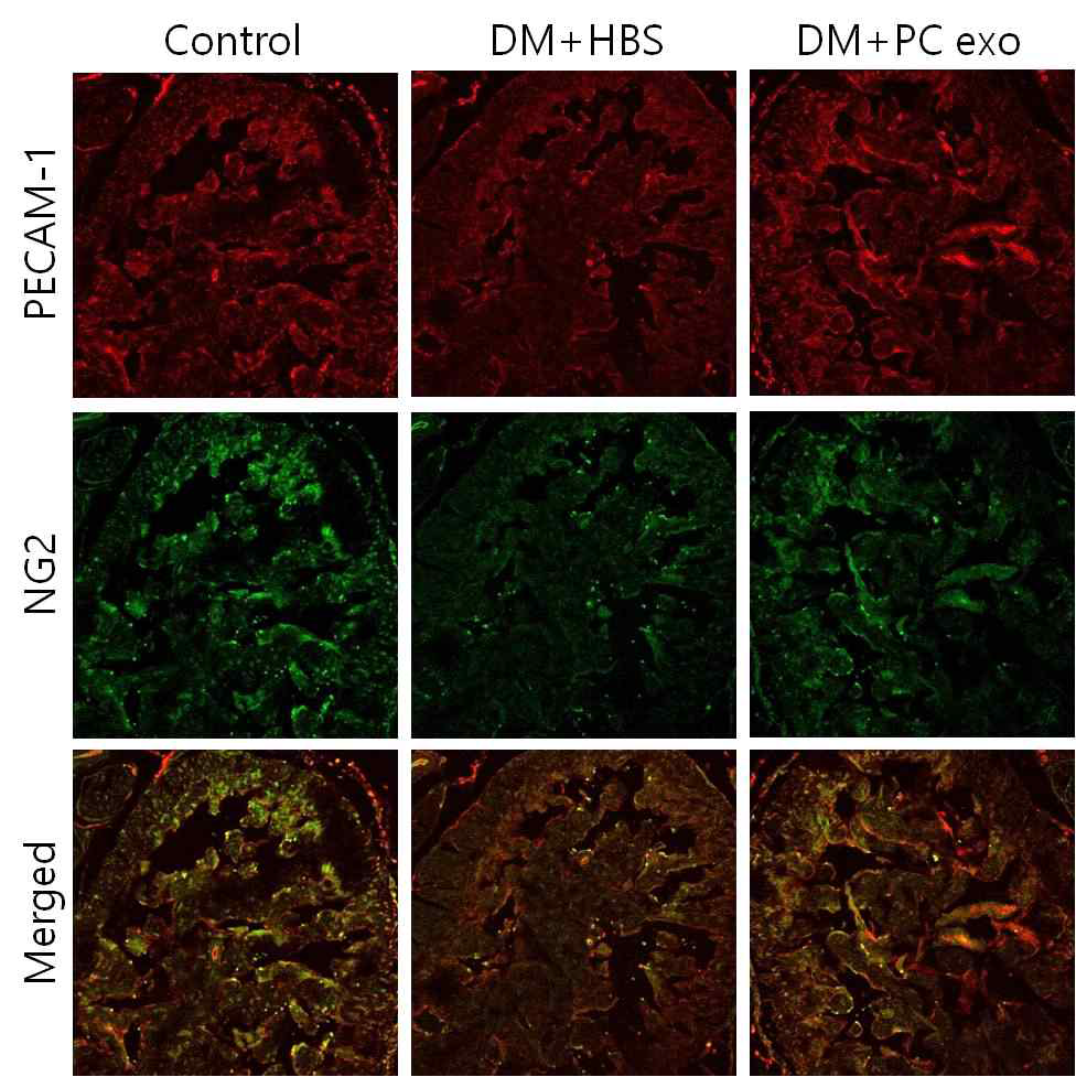 Pericyte-derived exosome increases cavernous endothelial cell and pericyte cell content in diabetic mice