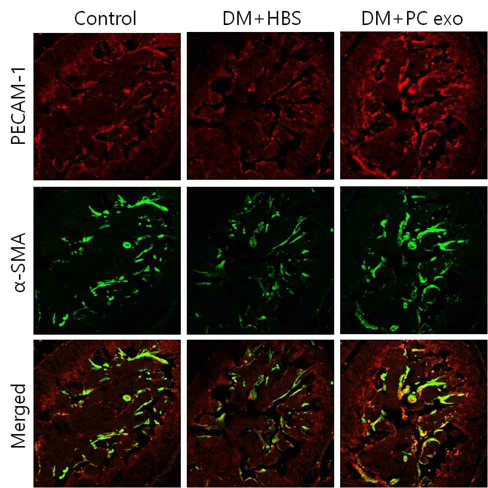 Pericyte-derived exosome increases cavernous smooth muscle cell content in diabetic mice