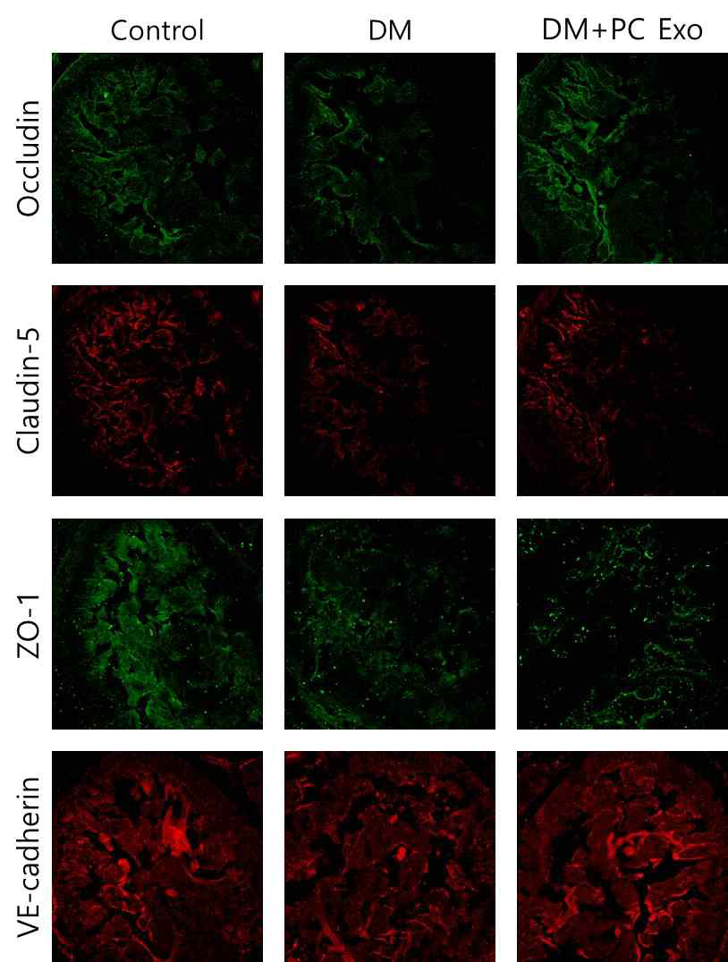 Pericyte-derived exosome restores cavernous endothelial cell-cell junction proteins in diabetic mice