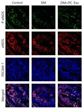 Pericyte-derived exosome induces cavernous eNOS phosphorylation in diabetic mice