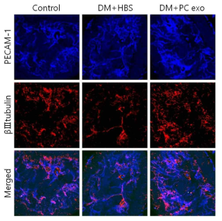 Pericyte-derived exosome increases nerve cell content in diabetic mice