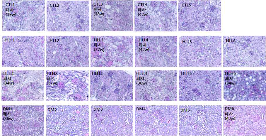 HL-156 투여에 따른 NZBWF/1 mice 의 kidney 조직