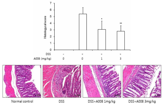Effects of A008 on the colonic histological property of DSS-induced colitis. (a) Representative microscopic images of hematoxylin and eosin (H&E) stained colon sections in each group. (b) Cumulative histology scores for each group. Data represent the mean ± SD (n = 3-5 per group). * < 0.05 and ** < 0.01 verss DSS