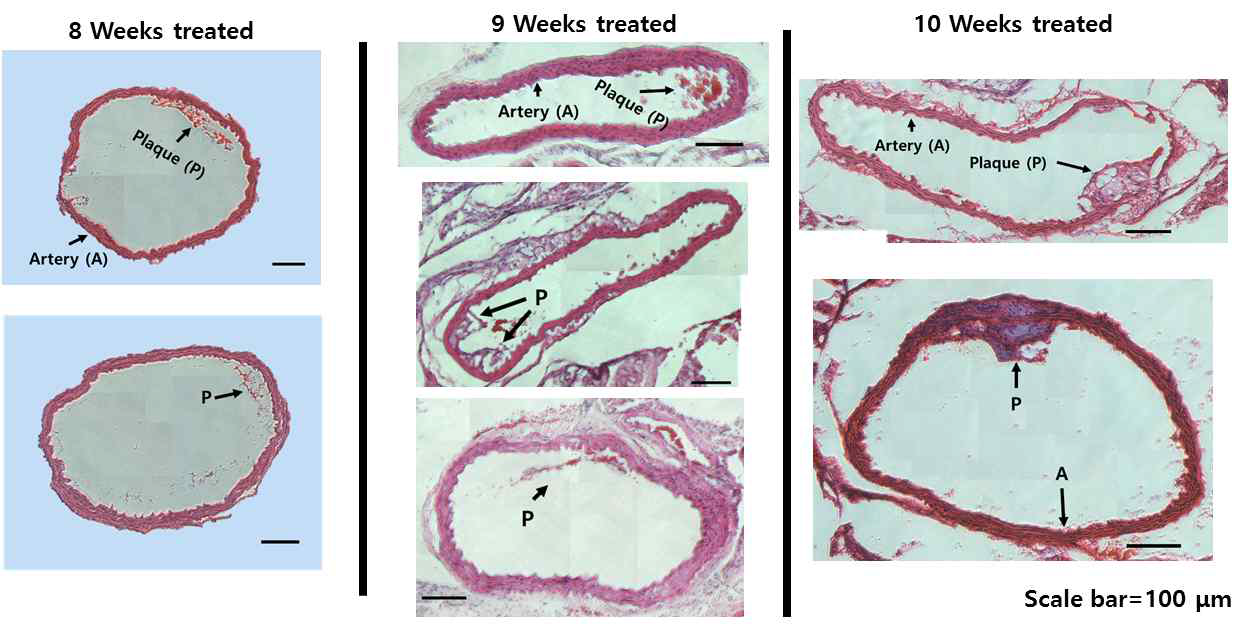 H&E staining을 이용한 각각 다른 고콜레스테롤 먹이 처리 기간에 따른 ApoE KO mice의 혈관 내 플라그 형성 정도 비교 결과