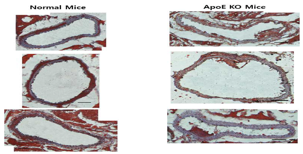 Oil red O staining을 이용한 10주간 고콜레스테롤 먹이 처리 후, 일반 C57BL/6 mice와 ApoE KO mice의 혈관 내 플라그 형성 정도 비교 결과 (Scale bar= 100 μm)