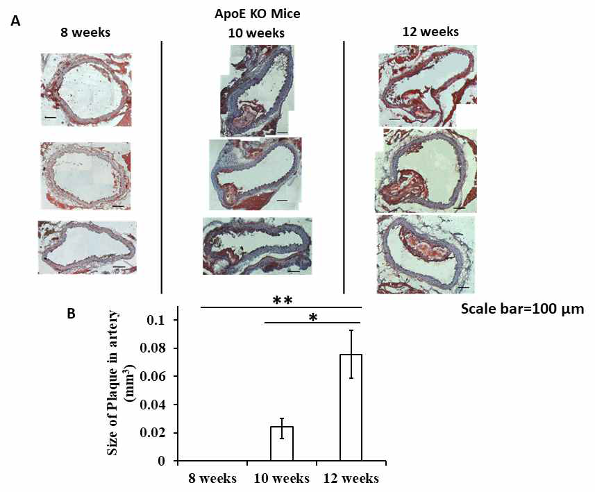 (A) Oil red O staining을 이용한 고콜레스테롤 먹이처리 기간에 따른 ApoE KO mice 혈관 내 플라그 정도 비교와 (B) 그를 통한 정량분석 결과 (*=p<0.05, **=p<0.01 by ANOVA and t-test)